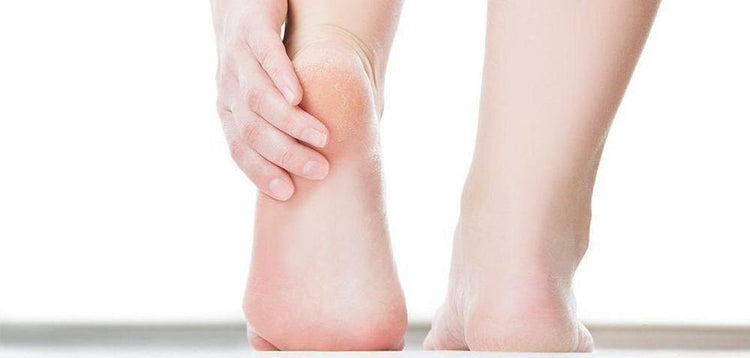 Qu'est-ce que la corne des pieds et les callosités ?-Scholl France