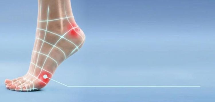 Quelles sont les causes des ampoules aux pieds ? - Scholl France