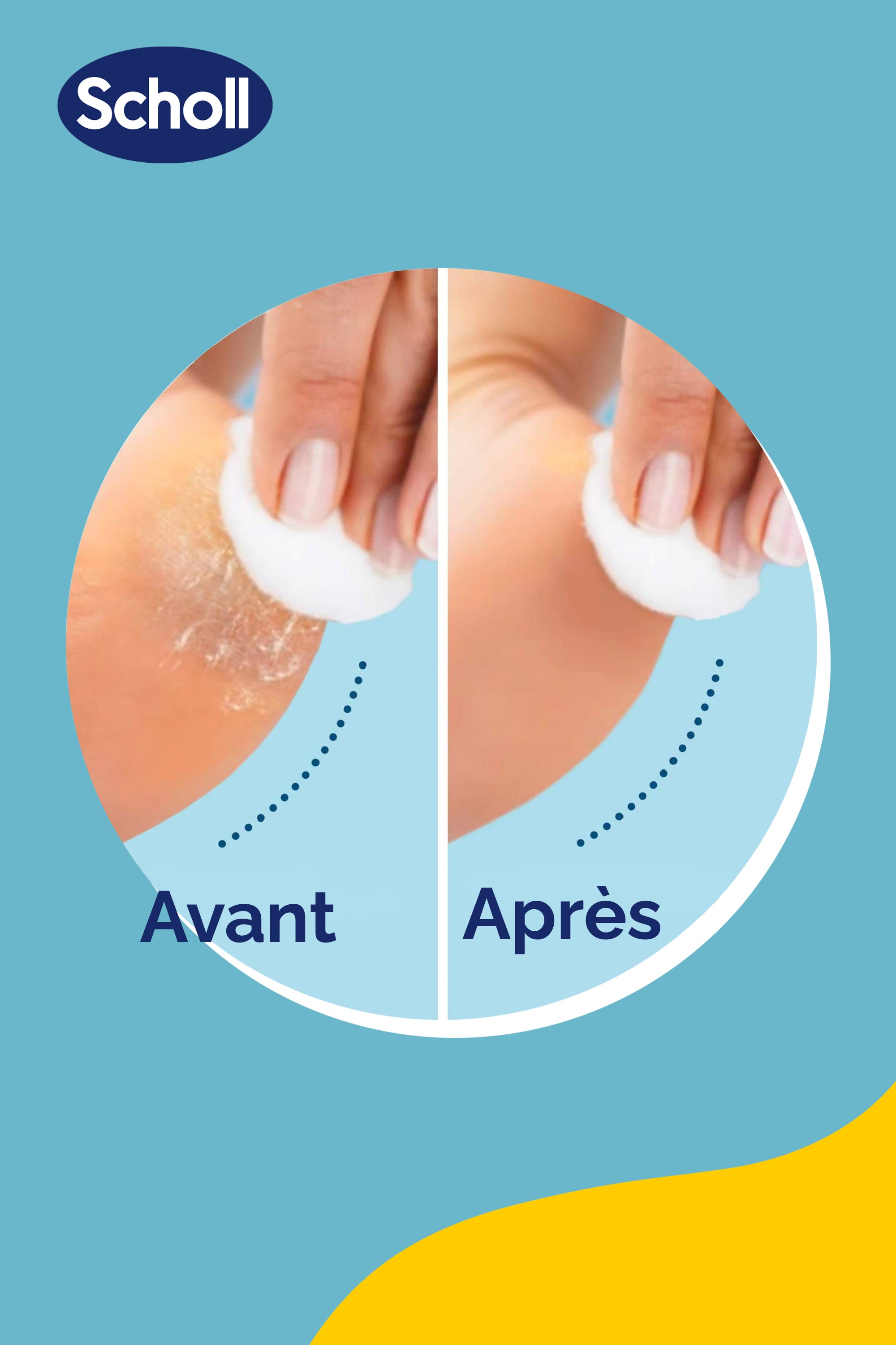 Rouleaux de Remplacement Scholl 2 en 1 Exfoliant & Lissant pour Râpe Electrique