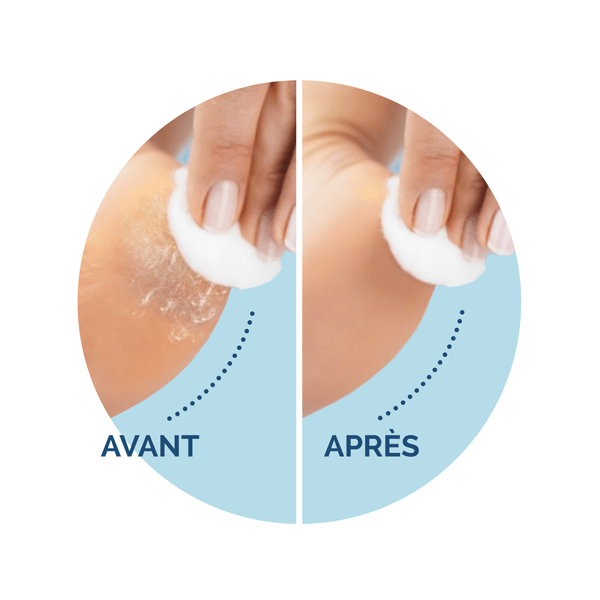 Recharges Scholl Velvet Smooth Grain Ultra Exfoliant